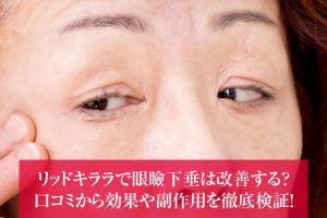 リッドキララで眼瞼下垂は改善する？口コミから効果や副作用を徹底検証！